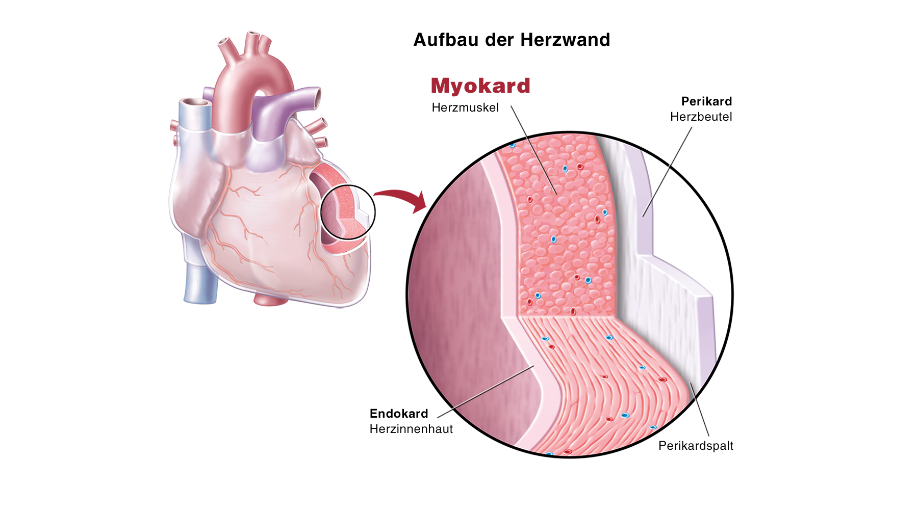 Ursachen Einer Endokarditis Herzstiftung