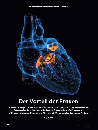 Herzklappenoperation Diese Verfahren Gibt Es Herzstiftung