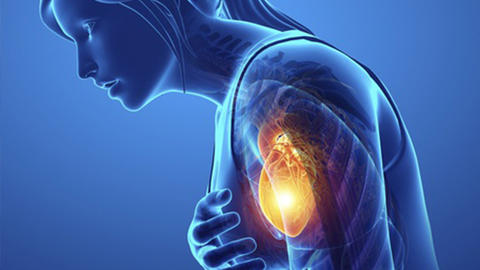Alle Fakten Zur Angina Pectoris Herzstiftung