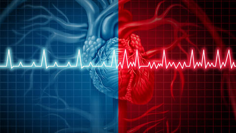 Vorhofflimmern gefährliche Herzrhythmusstörung